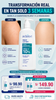 Aclara-T® Crema ultrahidratante con Urea al 10% - Adiós a la queratosis pilaris y resequedad